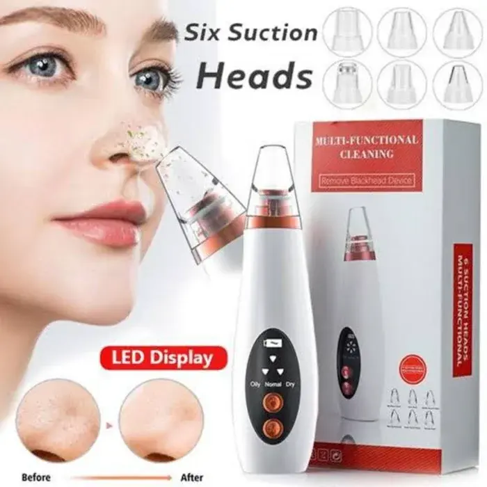 Electric Blackhead & Whitehead Removal Vacuum Cleaner - ত্বক গভীর থেকে পরিষ্কারের রিচার্জেবল বিউটি টুল